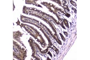 IHC testing of FFPE mouse small intestine tissue with Glutathione Reductase antibody at 1ug/ml. (Glutathione Reductase Antikörper)