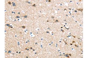 The image on the left is immunohistochemistry of paraffin-embedded Human brain tissue using ABIN7190906(HAUS7 Antibody) at dilution 1/30, on the right is treated with synthetic peptide. (HAUS7 Antikörper)