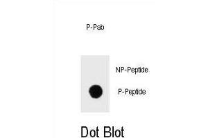 Dot blot analysis of Phospho-IKKB- Antibody Phospho-specific Pab (ABIN1539709 and ABIN2839874) on nitrocellulose membrane.