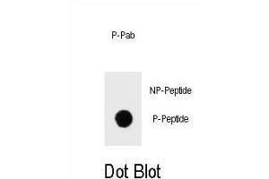 Dot blot analysis of Phospho-IKKB- Antibody Phospho-specific Pab (ABIN1539709 and ABIN2839874) on nitrocellulose membrane. (IKBKB Antikörper  (pSer675))