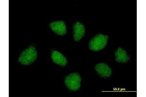 Immunofluorescence of purified MaxPab antibody to C1orf164 on HeLa cell. (RNF220 Antikörper  (AA 1-566))
