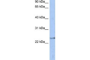 WB Suggested Anti-ATP6V1E2 Antibody Titration: 0. (ATP6V1E2 Antikörper  (Middle Region))