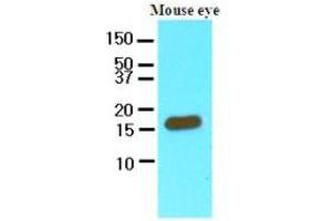 Western Blotting (WB) image for anti-Cellular Retinoic Acid Binding Protein 2 (CRABP2) (AA 1-138), (N-Term) antibody (ABIN356225) (CRABP2 Antikörper  (N-Term))