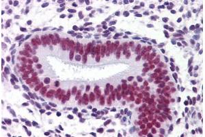 Uterus: Formalin-Fixed, Paraffin-Embedded (FFPE) (CHD4 Antikörper  (AA 1632-1731))