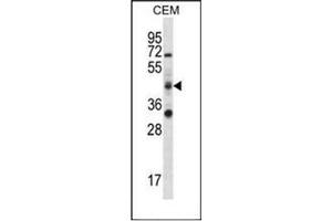Western blot analysis of RBM42 Antibody (C-term) in CEM cell line lysates (35ug/lane). (RBM42 Antikörper  (C-Term))