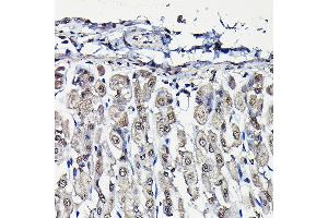 Immunohistochemistry of paraffin-embedded mouse stomach using PFKFB3 Rabbit pAb (ABIN6129841, ABIN6145485, ABIN6145487 and ABIN6222692) at dilution of 1:25 (40x lens). (PFKFB3 Antikörper  (AA 400-500))