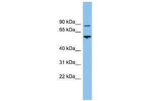 VPS52 antibody used at 1 ug/ml to detect target protein. (VPS52 Antikörper)