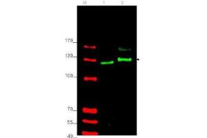 Western blot using  affinity purified anti-Gli-2 antibody shows detection of Gli-2 protein in rat testes (lane 1) and human HEK293 (lane 2) whole cell lysates (arrowhead). (GLI2 Antikörper  (Internal Region))