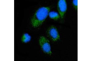 IF analysis of ALAS2/ASB using anti-ALAS2/ASB antibody (ABIN7599056).