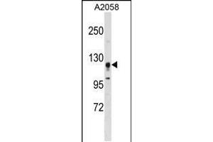 Western blot analysis in A2058 cell line lysates (35ug/lane). (STK31 Antikörper  (N-Term))