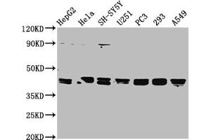 Western Blot Positive WB detected in: HepG2 whole cell lysate, Hela whole cell lysate, SH-SY5Y whole cell lysate, U251 whole cell lysate, PC-3 whole cell lysate, 293 whole cell lysate, A549 whole cell lysate All lanes: TPST1 antibody at 1:2000 Secondary Goat polyclonal to rabbit IgG at 1/50000 dilution Predicted band size: 43 kDa Observed band size: 43 kDa (TPST1 Antikörper  (AA 283-370))