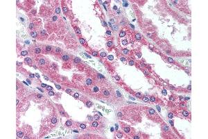 Immunohistochemistry (IHC) image for anti-Wingless-Type MMTV Integration Site Family, Member 1 (WNT1) (Internal Region) antibody (ABIN1049465)