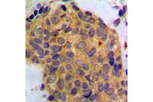 Immunohistochemistry (IHC) image for anti-Wingless-Type MMTV Integration Site Family, Member 1 (WNT1) (C-Term) antibody (ABIN7297280)