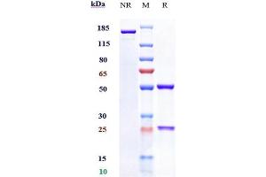 Anti-C1s Reference Antibody (sutimlimab) on SDS-PAGE under reducing (R) condition.