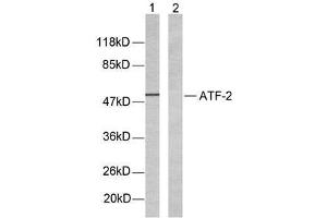 Western blot analysis of extracts from LOVO cells using ATF-2(Ab-69 or 51) antibody (E021030). (ATF2 Antikörper)