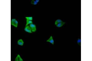 Immunofluorescence staining of Hela Cells with ABIN7127469 at 1:50, counter-stained with DAPI. (Rekombinanter EIF5A Antikörper)