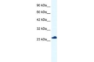 WB Suggested Anti-C14orf166 Antibody Titration:  0. (C14orf166 Antikörper  (N-Term))