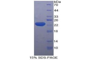 SDS-PAGE analysis of Human HMGCS Protein. (HMGCS1 Protein)