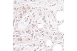 Immunohistochemistry (IHC) image for anti-Geminin, DNA Replication Inhibitor (GMNN) (AA 50-100) antibody (ABIN7453937)