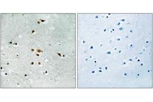 Immunohistochemistry analysis of paraffin-embedded human brain, using FER (Phospho-Tyr402) Antibody. (FER Antikörper  (pTyr402))