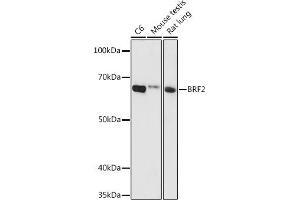 Western blot analysis of extracts of various cell lines, using BRF2 antibody (ABIN6129998, ABIN6137657, ABIN6137658 and ABIN6224790) at 1:1000 dilution. (BRF2 Antikörper  (AA 1-120))