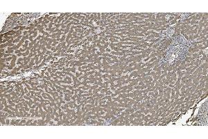 IHC analysis of SHMT1 using anti-SHMT1 antibody (ABIN7599420).