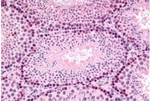 Mouse, Testis (formalin-fixed, paraffin-embedded) stained with GLI2 antibody ABIN214612 at 5 ug/ml followed by biotinylated goat anti-rabbit IgG secondary antibody ABIN481713, alkaline phosphatase-streptavidin and chromogen. (GLI2 Antikörper  (Internal Region))