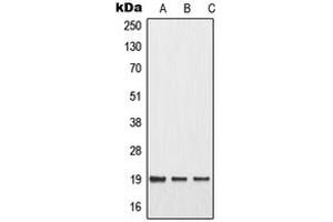 Western blot analysis of MMP1 22k expression in MCF7 UV-treated (A), mouse liver (B), rat liver (C) whole cell lysates. (MMP1 22k Antikörper  (Center))