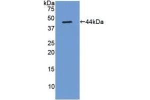 Detection of Recombinant Gastrin, Rat using Polyclonal Antibody to Gastrin (GT) (Gastrin Antikörper  (AA 1-104))