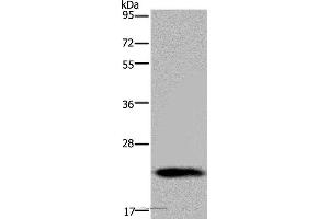 Western blot analysis of Human placenta tissue, using GH2 Polyclonal Antibody at dilution of 1:700 (Growth Hormone 2 Antikörper)