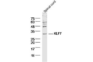 Mouse Spinal cord lysates probed with KLF7 Polyclonal Antibody, Unconjugated  at 1:300 dilution and 4˚C overnight incubation.