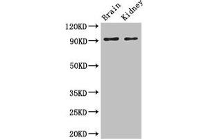 Western Blot Positive WB detected in: Mouse brain tissue, Mouse kidney tissue All lanes: SLC9A1 antibody at 3 μg/mL Secondary Goat polyclonal to rabbit IgG at 1/50000 dilution Predicted band size: 91, 62 kDa Observed band size: 91 kDa