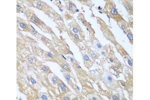 Immunohistochemistry of paraffin-embedded Human liver using PPP4R1 Polyclonal Antibody at dilution of 1:100 (40x lens). (PPP4R1 Antikörper)