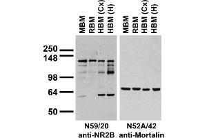 Immunoblots on brain membranes prepared from whole rat (RBM) and mouse (MBM) brain, and from human cerebral cortex [HBM(Cx)] and hippocampus [HBM(H)] probed with N59/20 (left) or N52A/42 (right) TC supe.