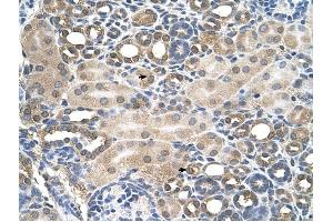 HFE antibody was used for immunohistochemistry at a concentration of 4-8 ug/ml to stain Epithelial cells of renal tubule (arrows) in Human Kidney.