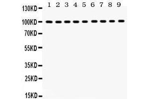 Western Blotting (WB) image for anti-Nuclear Receptor Subfamily 3, Group C, Member 1 (Glucocorticoid Receptor) (NR3C1) (AA 20-199) antibody (ABIN3043371)