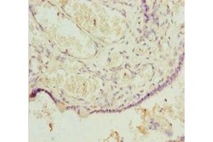 Immunohistochemistry of paraffin-embedded human placenta tissue using ABIN7164067 at dilution of 1:100 (POU4F3 Antikörper  (AA 1-180))