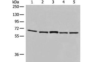 Western blot analysis of TM4 and 231 cell Mouse brain tissue Hela and HT-29 cell lysates using EHD1 Polyclonal Antibody at dilution of 1:500 (EHD1 Antikörper)