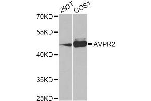 Western blot analysis of extracts of various cell lines, using AVPR2 Antibody.