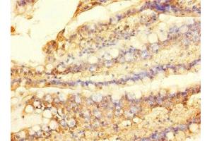Immunohistochemistry of paraffin-embedded human small intestine tissue using ABIN7170032 at dilution of 1:100 (SLC28A1 Antikörper  (AA 1-80))