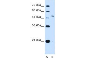Western Blotting (WB) image for anti-Potassium Voltage-Gated Channel, Shaw-Related Subfamily, Member 1 (KCNC1) antibody (ABIN2462986) (KCNC1 Antikörper)