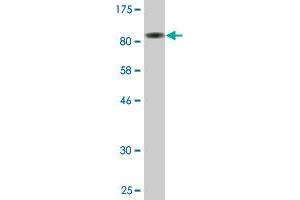 Western Blot detection against Immunogen (82. (PDZK1 Antikörper  (AA 1-519))