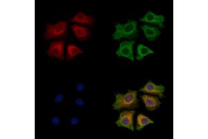 anti-Small Proline-Rich Protein 3 (SPRR3) (Internal Region) antibody