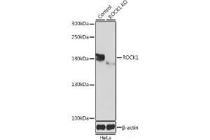 Western blot analysis of extracts from normal (control) and ROCK1 knockout (KO) HeLa cells using ROCK1 Polyclonal Antibody at dilution of 1:1000. (ROCK1 Antikörper)