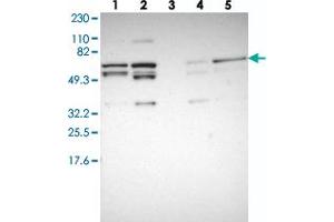 Western blot analysis of Lane 1: RT-4, Lane 2: U-251 MG, Lane 3: Human Plasma, Lane 4: Liver, Lane 5: Tonsil with C14orf133 polyclonal antibody .