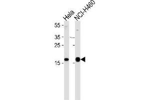Western blot analysis of NDP kinase A Antibody (C-term) Cat. (NME1 Antikörper  (C-Term))