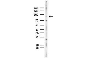anti-Ataxin 7-Like 1 (ATXN7L1) (N-Term) antibody