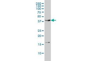 CAMK1 monoclonal antibody (M01), clone 3G1 Western Blot analysis of CAMK1 expression in HL-60 . (CAMK1 Antikörper  (AA 271-370))