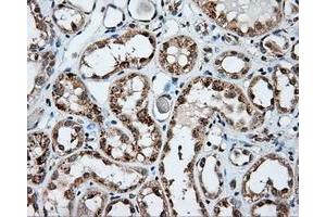 Immunohistochemical staining of paraffin-embedded Kidney tissue using anti-NPR3 mouse monoclonal antibody. (NPR3 Antikörper)
