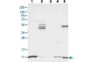 Western blot analysis of Lane 1: RT-4, Lane 2: U-251 MG, Lane 3: Human Plasma, Lane 4: Liver, Lane 5: Tonsil with SH3BGRL3 polyclonal antibody . (SH3BGRL3 Antikörper)